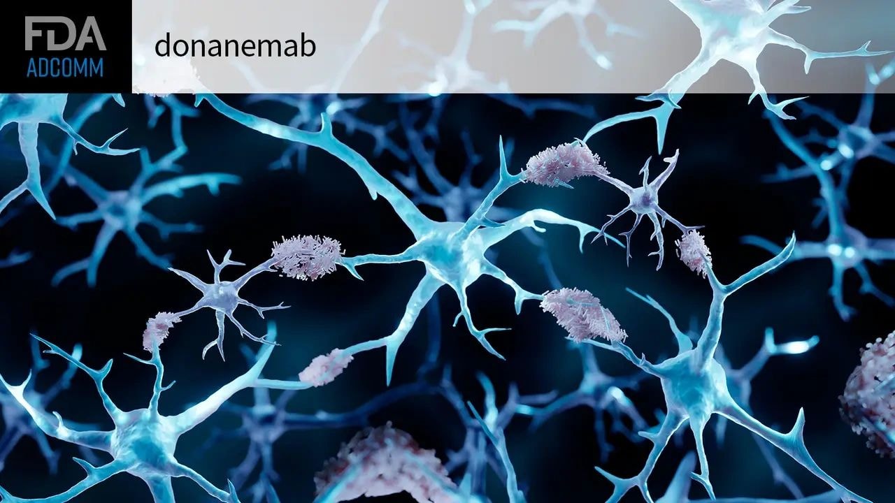 Donanemab Alzheimer's research